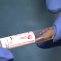 Coronavirus Covid-19 testing has reached 1,000