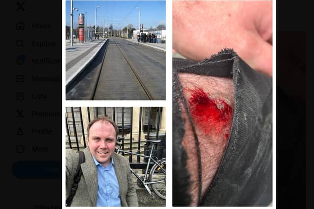 Cathal Crowe, a TD from Co Clare, shared his commute story to X (formerly Twitter) along with pictures of his bloody injury as a result from the fall this Tuesday, February 20.