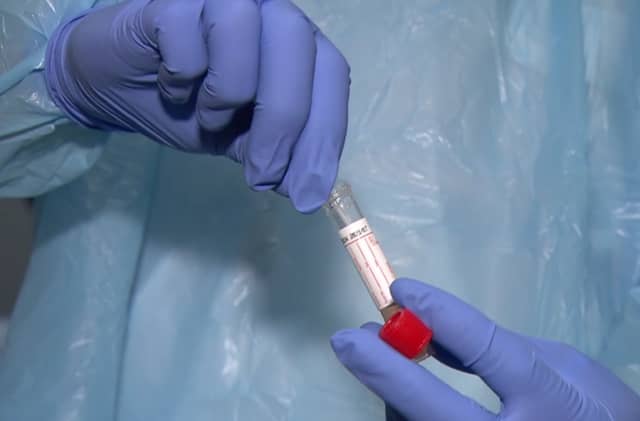 Coronavirus Covid-19 testing being expanded says GPs
