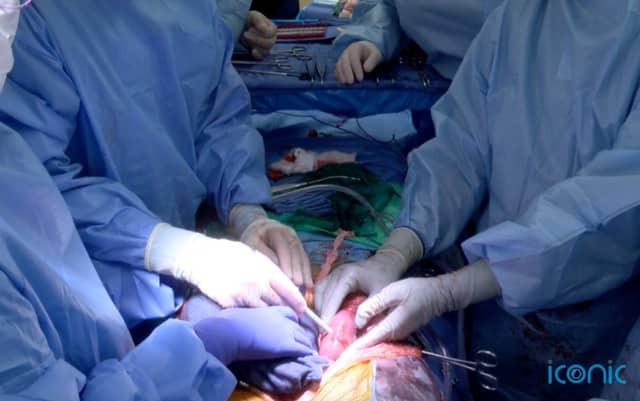 Experts now hope to carry out a clinical trial on living humans with serious kidney problems.