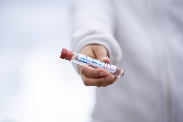 Irish scientists hunting genetic explanation for differences in Covid-19 severity