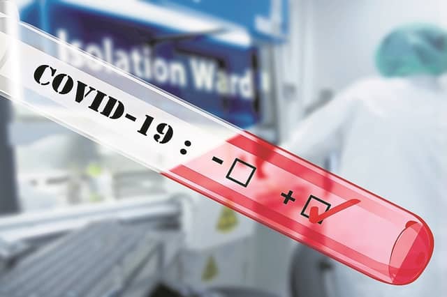 There have been 814 confirmed cases of Covid-19