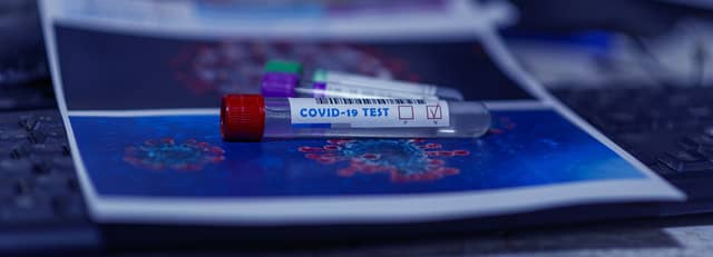 Significant rise in community Covid-19 testing referrals