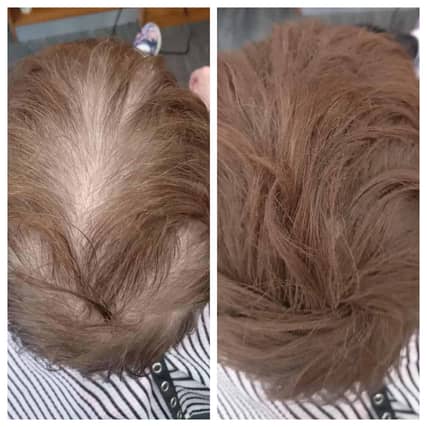 Locks On micro fibres give the appearance of an instant full head of hair