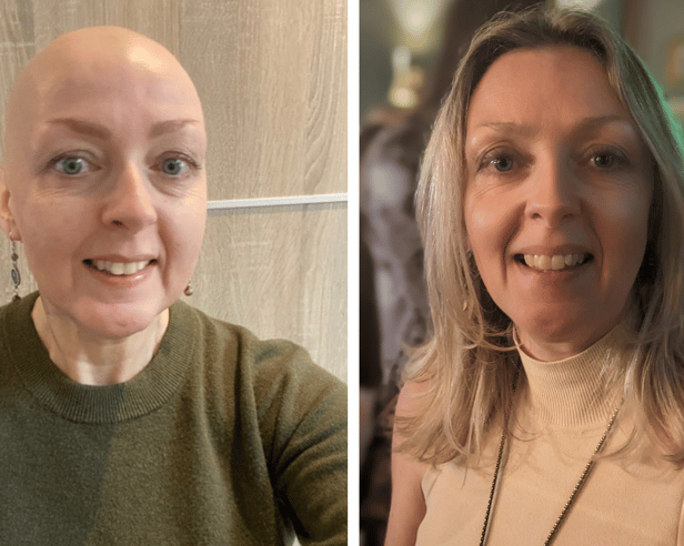Hazel Farrell during her cancer treatment and now