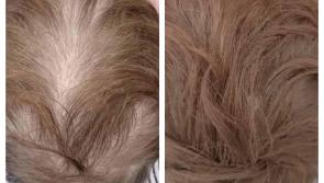 Thinning hair solution product for men and women at South East barbershop Get Your Locks Off