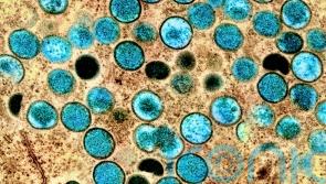 Vaccination advice for groups most at risk of monkeypox in Waterford to be issued soon