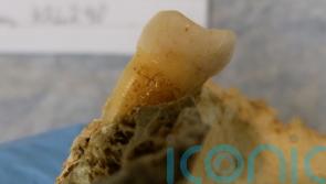 Brushing up on the Bronze Age: 4,000-year-old tooth found 