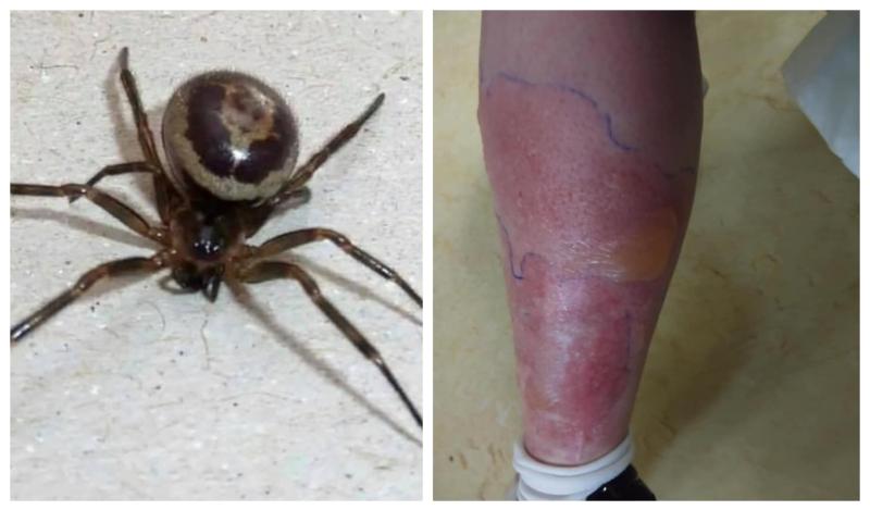 Deadly False Widow Spider Can Produce 1 000 Babies A Year Waterford Live deadly-false-widow-spider-can-produce-1-000-babies-a-year-waterford-live