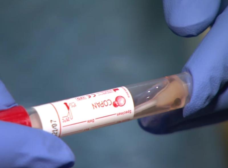 coronavirus covid-19