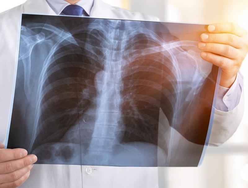 Flu vaccine advice issued to Irish people with COPD condition