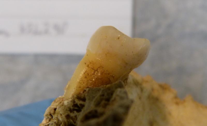 Brushing up on the Bronze Age: 4,000-year-old tooth found 