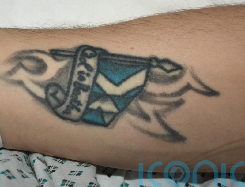 Gardai release tattoo image to help identify Temple Bar attack victim